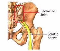 Joint stiffnes in cold weather that affect sciatica