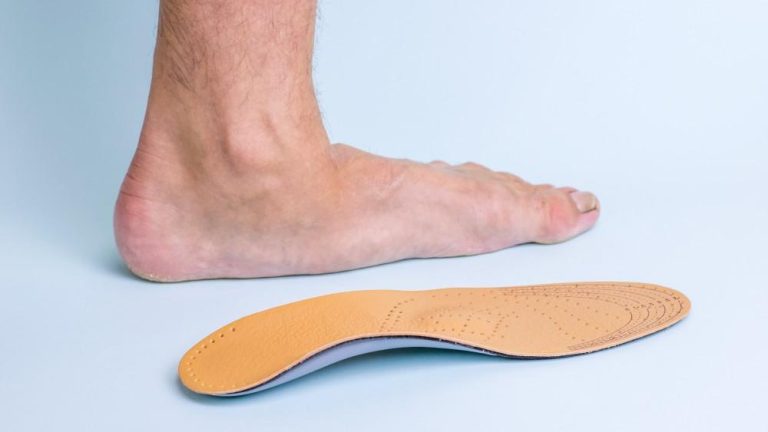 Can Flat Feet Cause Sciatica Pain
