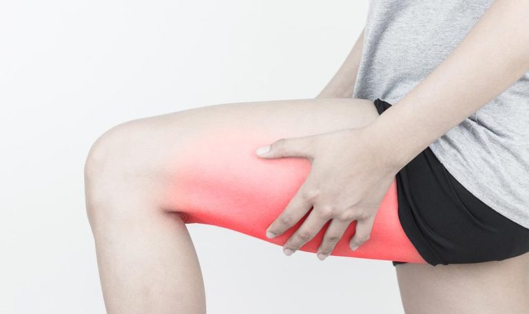Can Sciatica Cause Hamstring Pain